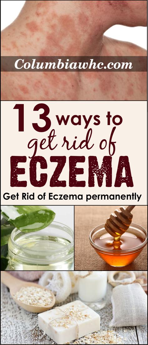 best vitamin for eczema|how to get rid of eczema fast.